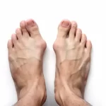 A pair of bare feet seen from above against a plain white background. The feet are parallel and close together, showing visible veins and light shadowing. The toes are slightly splayed, and the image has a minimalist composition.