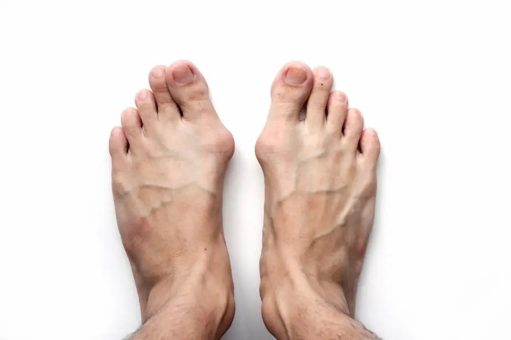 A pair of bare feet seen from above against a plain white background. The feet are parallel and close together, showing visible veins and light shadowing. The toes are slightly splayed, and the image has a minimalist composition.