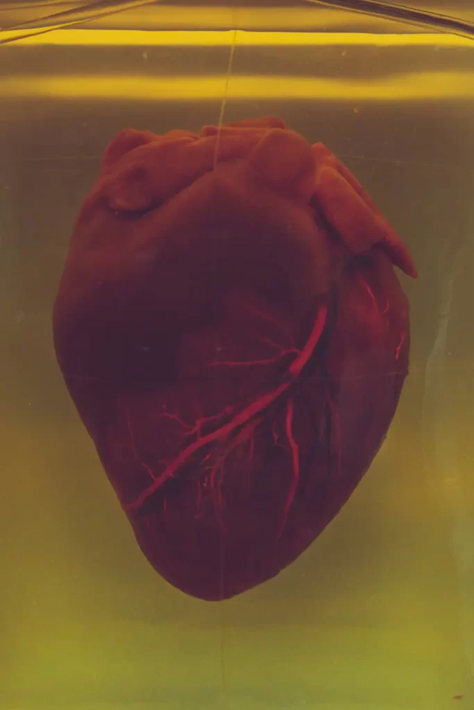 A preserved cardiomega lies in a transparent container filled with yellowish liquid. The dark heart, with visible red veins, creates a warm yet clinical atmosphere under the lighting.